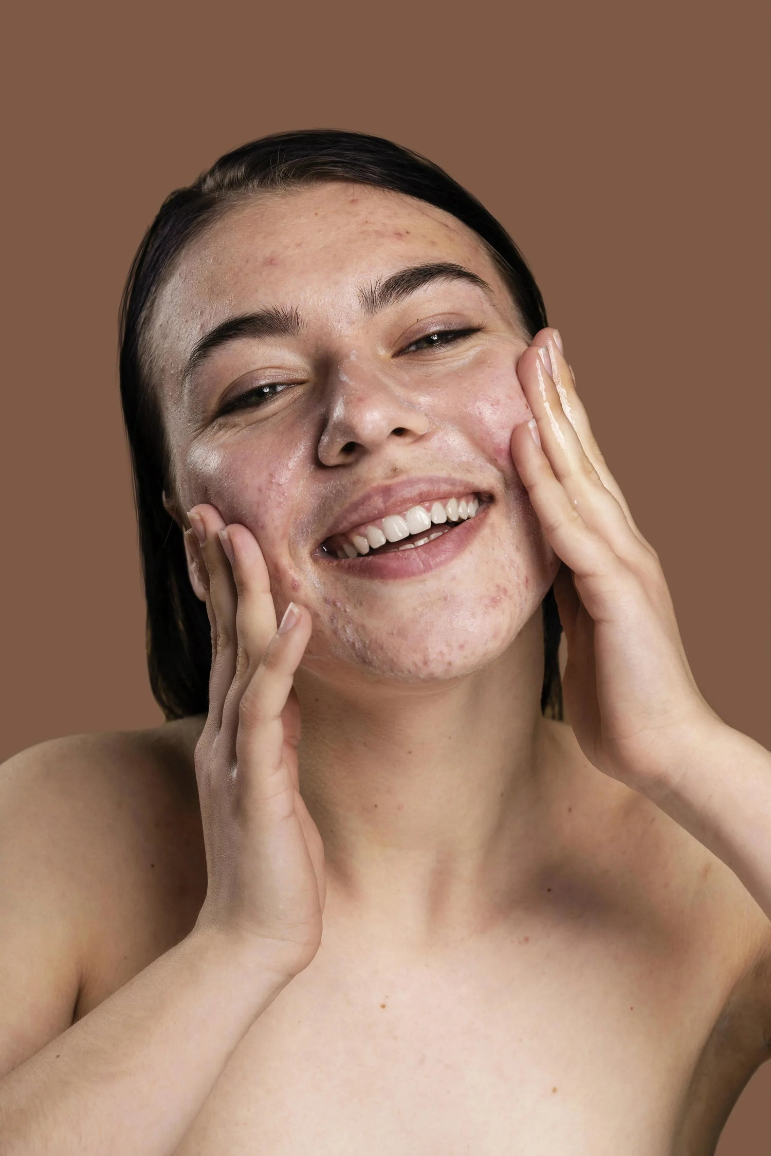 Piel acneica - Namü 나무