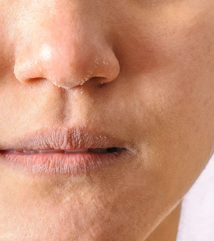 Piel_mixta_1 - Namü 나무